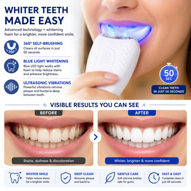 OraSonic | Ultrasonic Teeth Whitening Self-Brushing Toothbrush